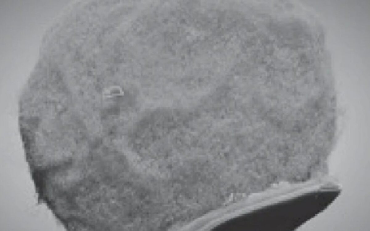 Le défi fascinant de lier cellules immunitaires et électronique pour soigner le cerveau