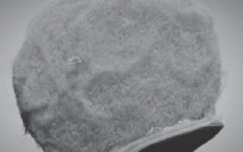 Le défi fascinant de lier cellules immunitaires et électronique pour soigner le cerveau