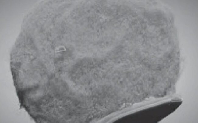 Le défi fascinant de lier cellules immunitaires et électronique pour soigner le cerveau