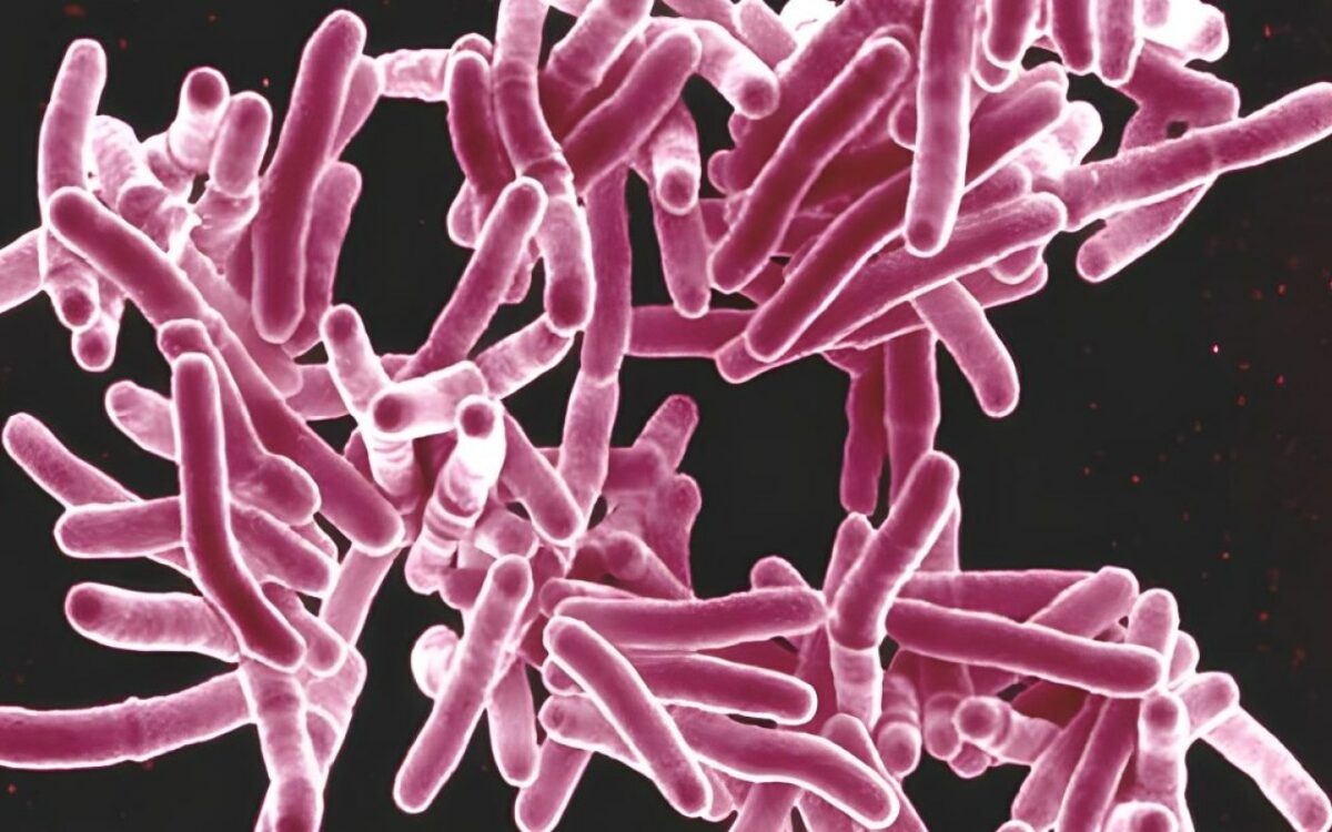 Le mystère troublant d'une infection rare et surprenante sur le pénis d'un homme en irlande