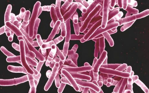 Le mystère troublant d'une infection rare et surprenante sur le pénis d'un homme en irlande