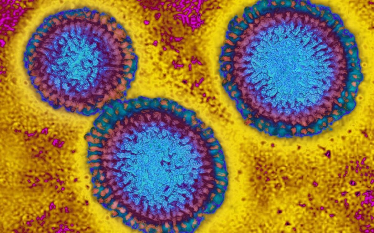 L'émergence d'une souche d'influenza h3n2 soulève des inquiétudes pour la santé publique en europe et aux états unis