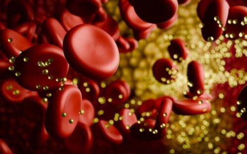 Un secret de santé familiale : comment un trouble héréditaire du cholestérol reste ignoré par les dépistages actuels